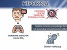 Hipoksja